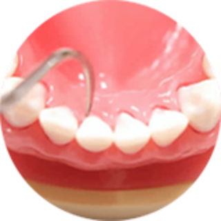 歯周病症例のアイコン