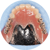 denture 入れ歯アイコン